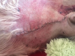 Sam's incision and staples